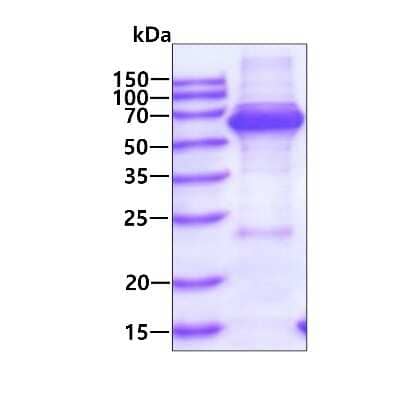 SDS-PAGE Recombinant Human TCP1 alpha His Protein